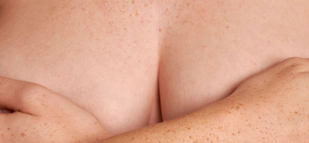 Bei welcher Körbchengröße Brustverkleinerung?