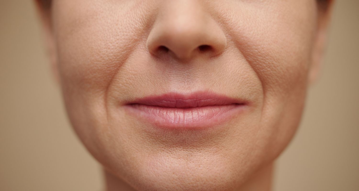 Fadenlifting bei Central Aesthetics in Frankfurt