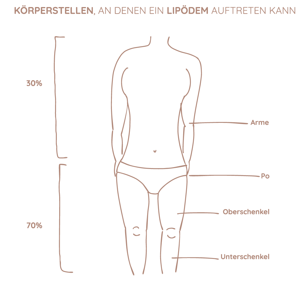 Lipödem Grafik Frankfurt