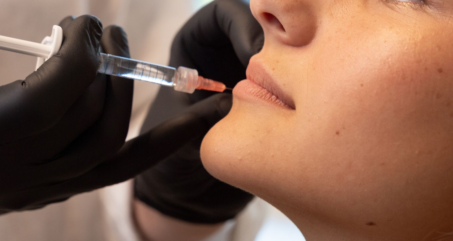 lippen-aufbau-in-frankfurt Brustimplantatwechsel in Frankfurt