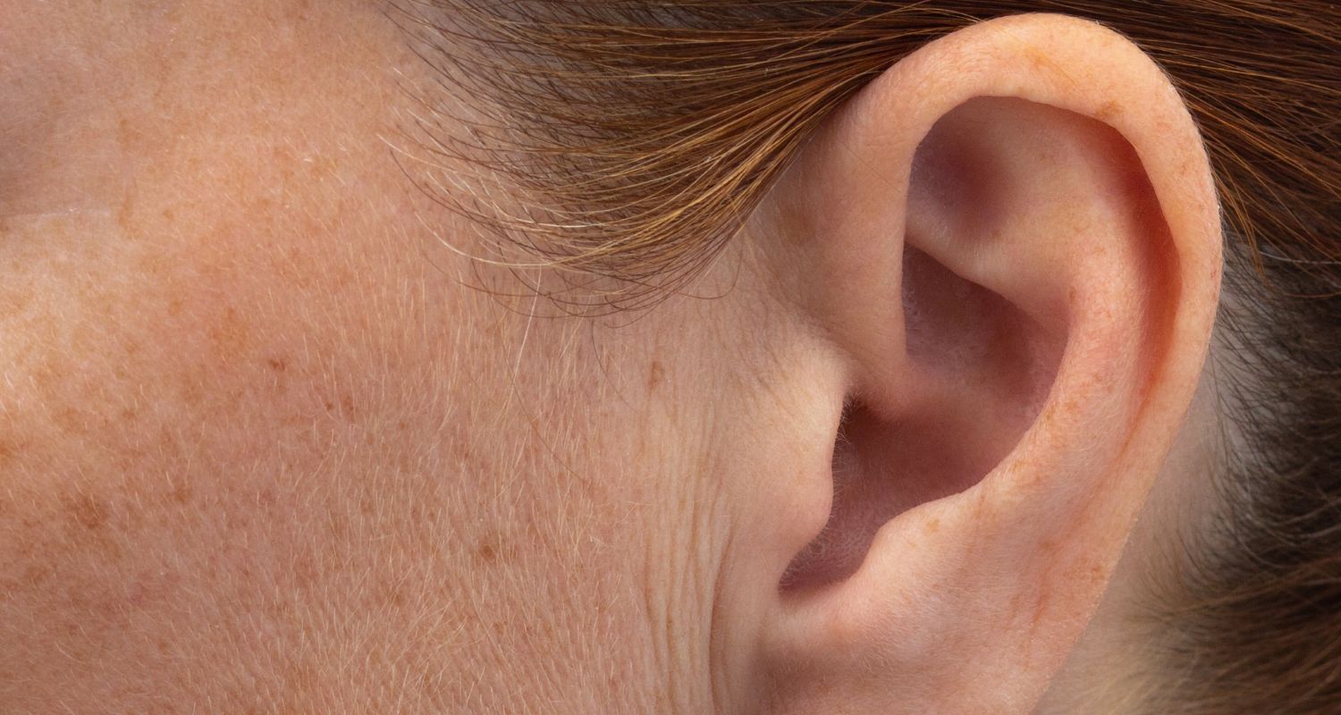 Ohrenkorrektur bei Central Aesthetics in Frankfurt