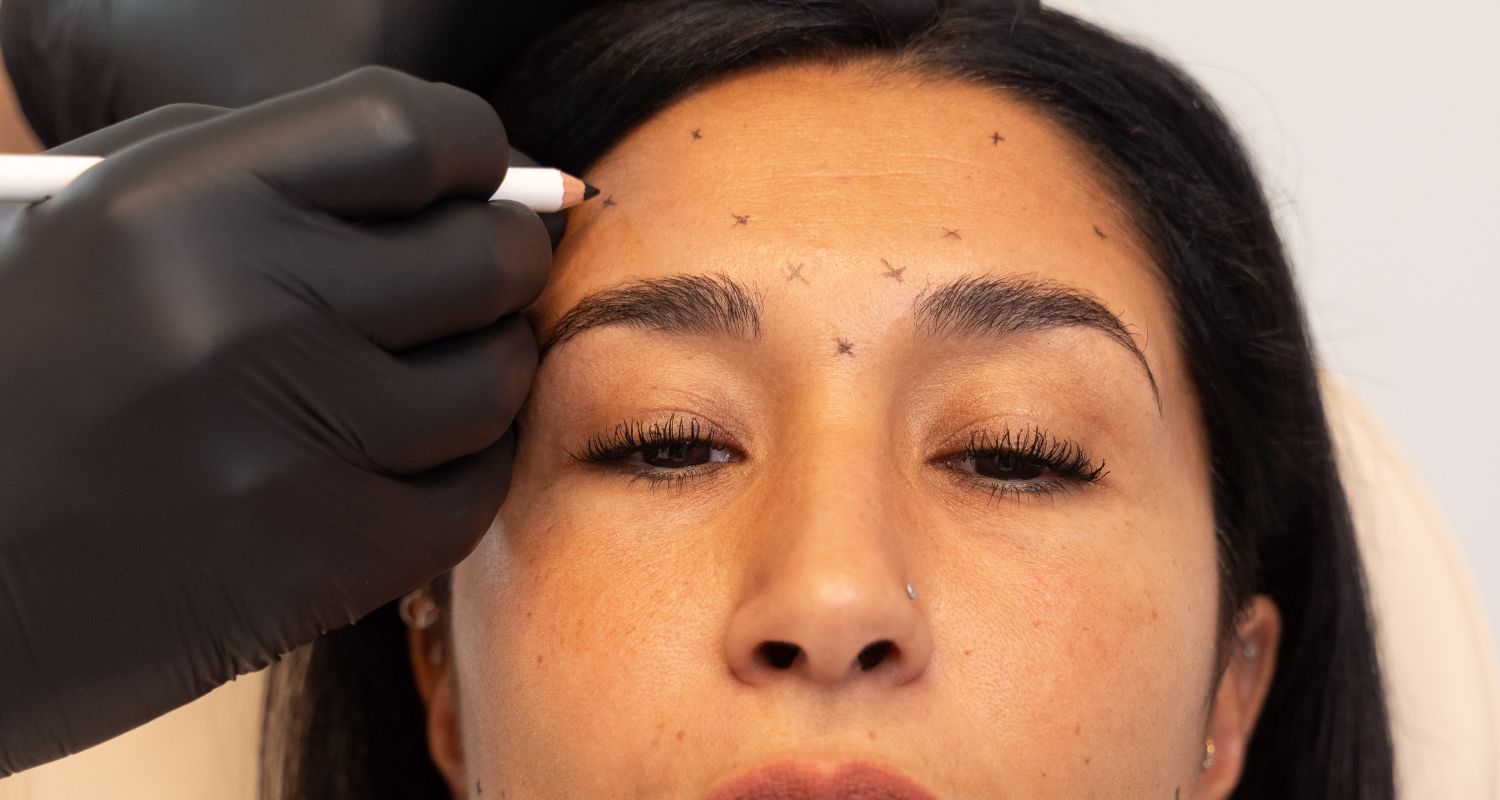 Faltenunterspritzung mit BTX in Frankfurt